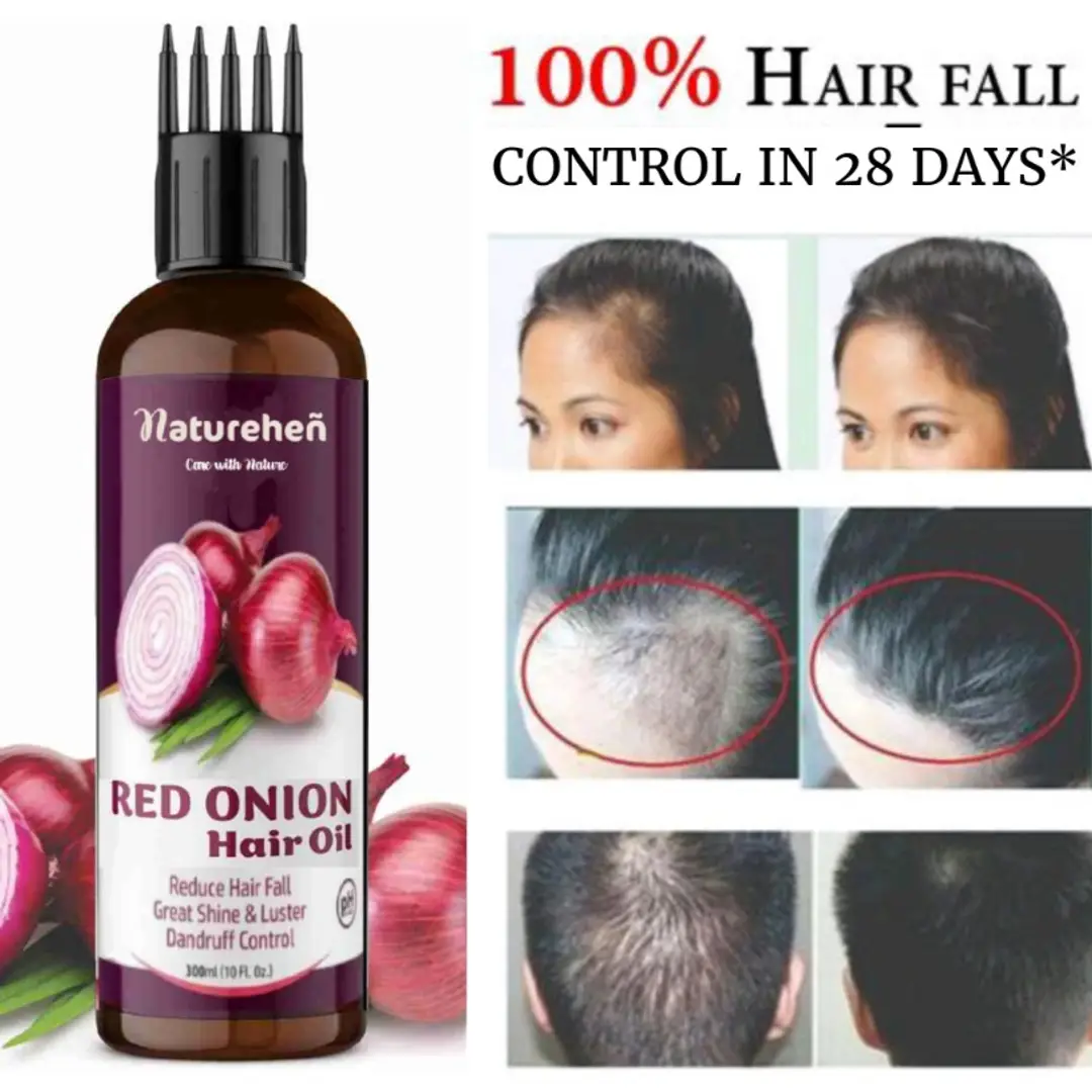 Red Onion and Ginger Hair Growth and Hair Fall Control Oil 100 ml