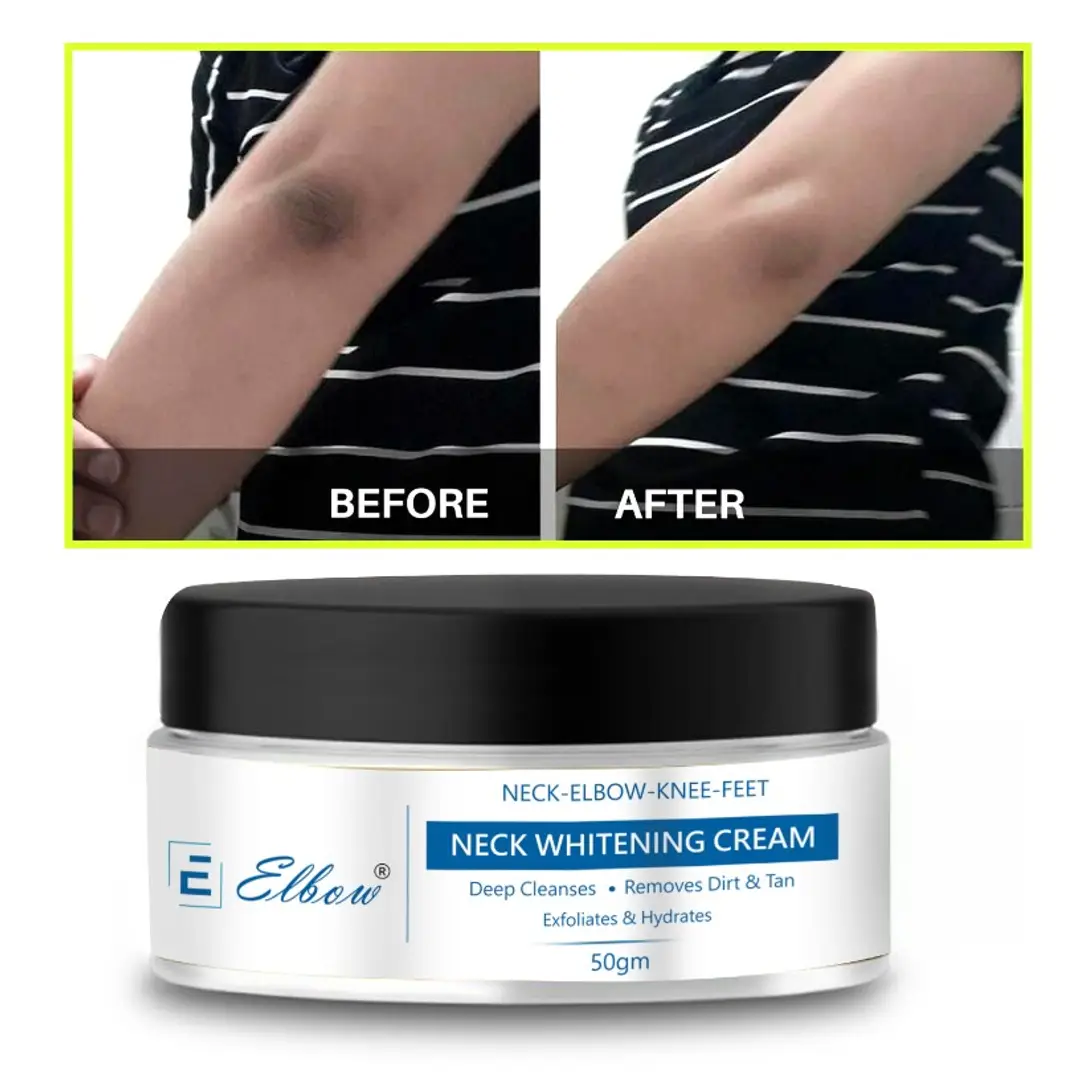 Pure Skin Whitening Cream Look As Young As U Feel Now Your Skin