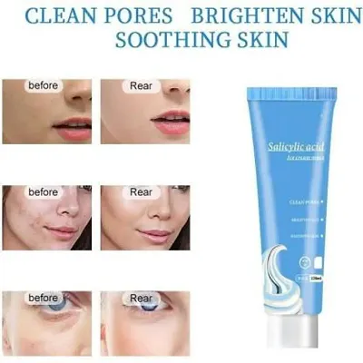 Skin Pearl Cream Beauty Cream For Stop the Acne Cycle And Scars Cream