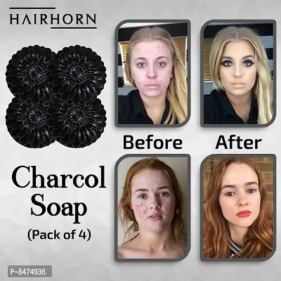 Charcoal Soap For Deep Pore Cleansing And Flawless Skin 100Gm Pack Of 4