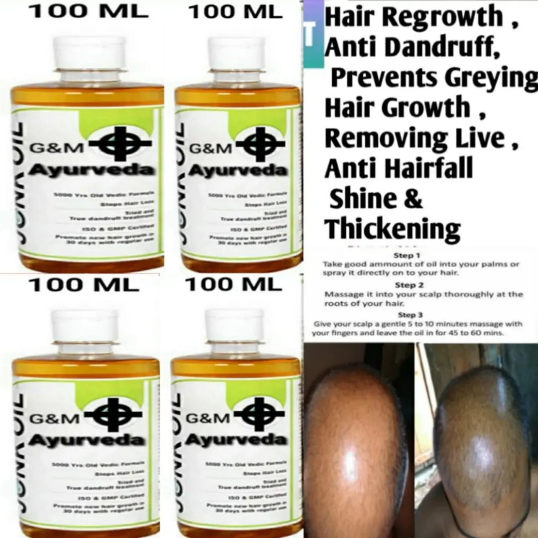 Discover more than 149 jonk hair oil best