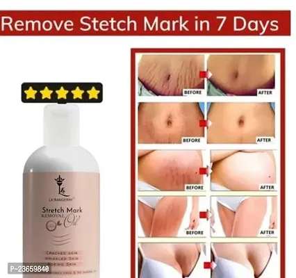 after pregnancy stretch marks cream after pregnancy breast size increase at  Rs 3599/piece, Stretch Marks Removal Cream in Haridwar