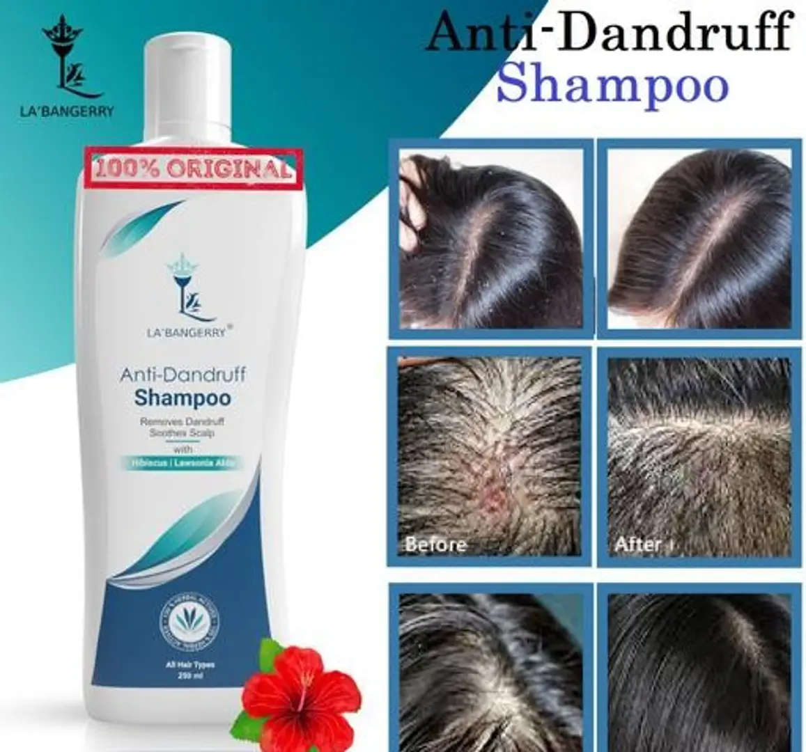 Buy Original Anti Dandruff Shampoo For Dandruff Control 250Ml Pack Of 1 ...